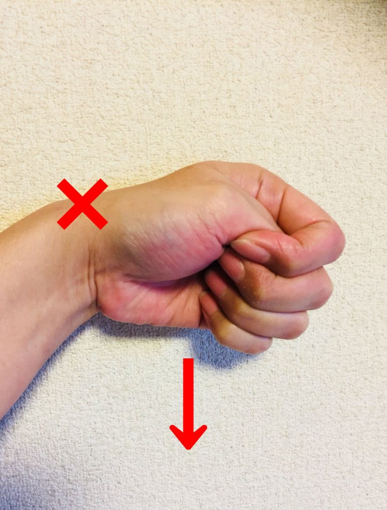 親指と手首を一緒に小指側に曲げたときに親指側の部分に痛みが出るのかの変化を見る検査