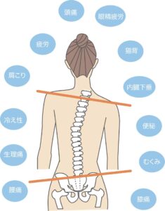骨盤がゆがむと不調が出る